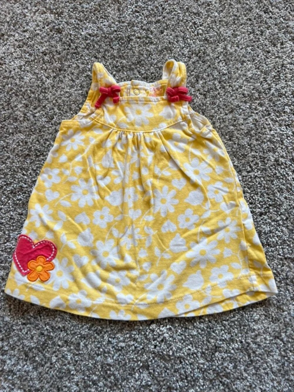 baby’s yellow dress